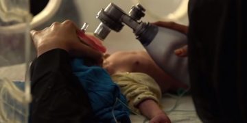 новость 30-07-2019 Йемен нуждается в помощи международного сообщества