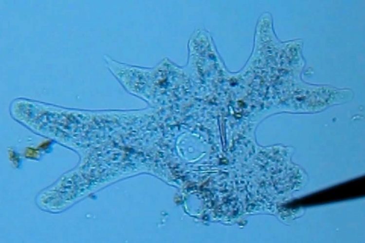 новость 17-09-2019 10-летняя девочка скончалась после заболевания амебой