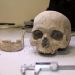В Стамбуле нашли 1000-летний череп и кости африканского человека