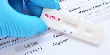 новость 23-08-2020 Необходимость тестирования на сovid-19 не пугает туристов