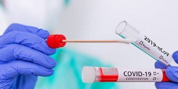 новость 10-10-2020 Сколько будет стоить тестирование на covid у туроператоров?