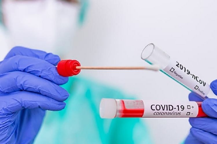 новость 10-10-2020 Сколько будет стоить тестирование на covid у туроператоров?