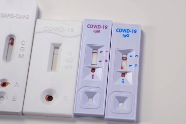 Туристы не всегда успевают получить тест на ковид вовремя