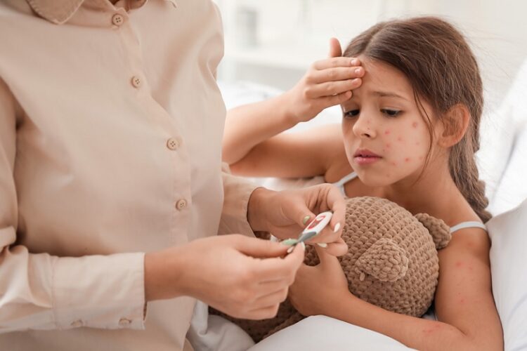 новость 05-06-2025 Если семейный отдых оказался под угрозой срыва из-за ветрянки