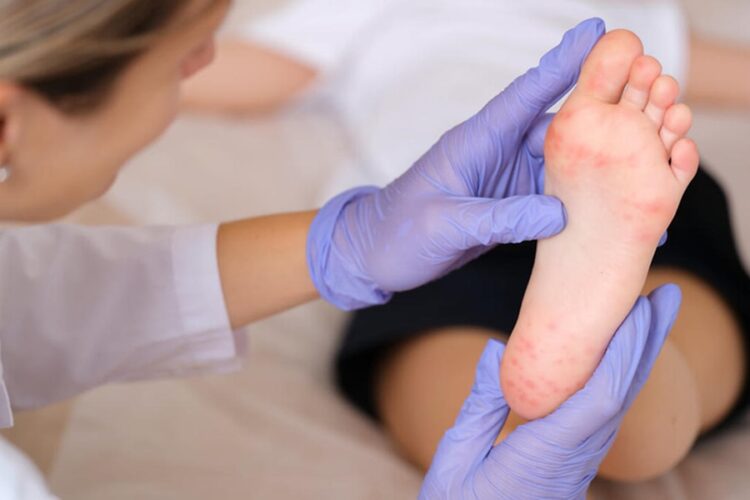 новость 07-10-2025 Информация о массовых вспышках вируса Коксаки в РФ не соответствует действительности